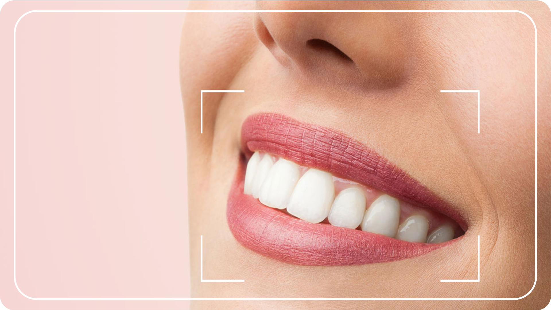 Como ter um sorriso perfeito com 7 dicas para arrasar.