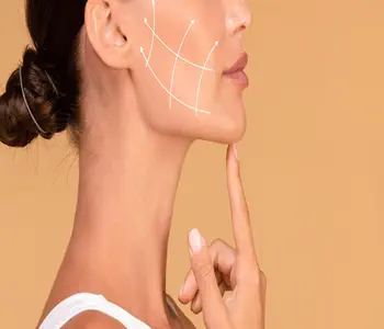 lipo enzimatica de papada antes e depois 01